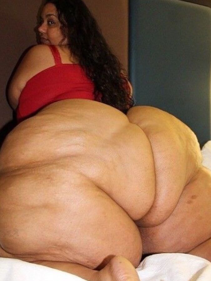 Nothing But Obese Legs