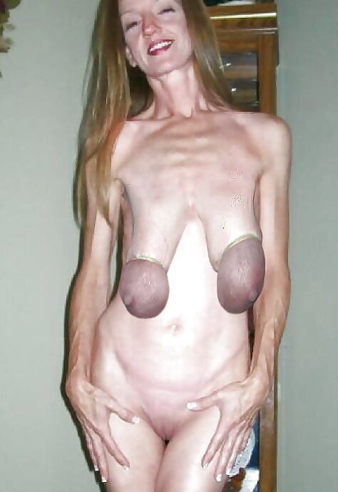 Sensatiomal TITS