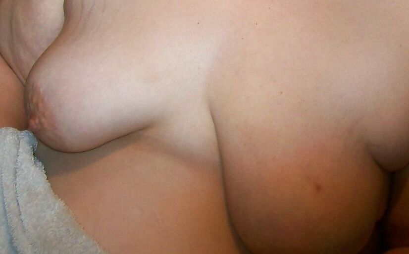 Bbw Breast