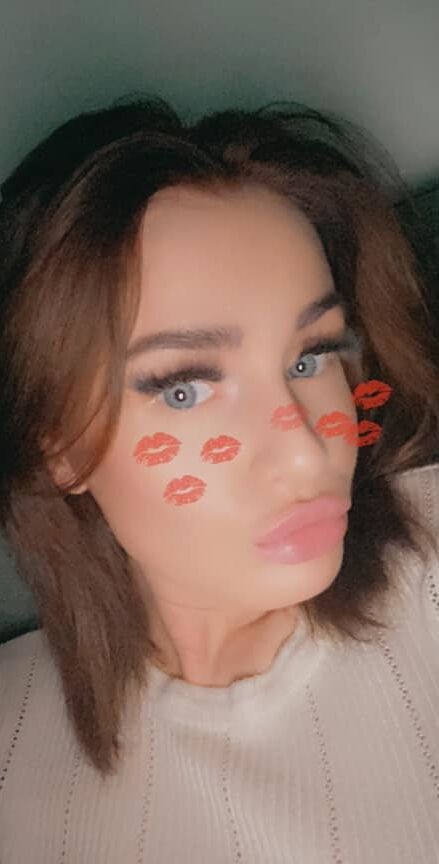 lip filer top up