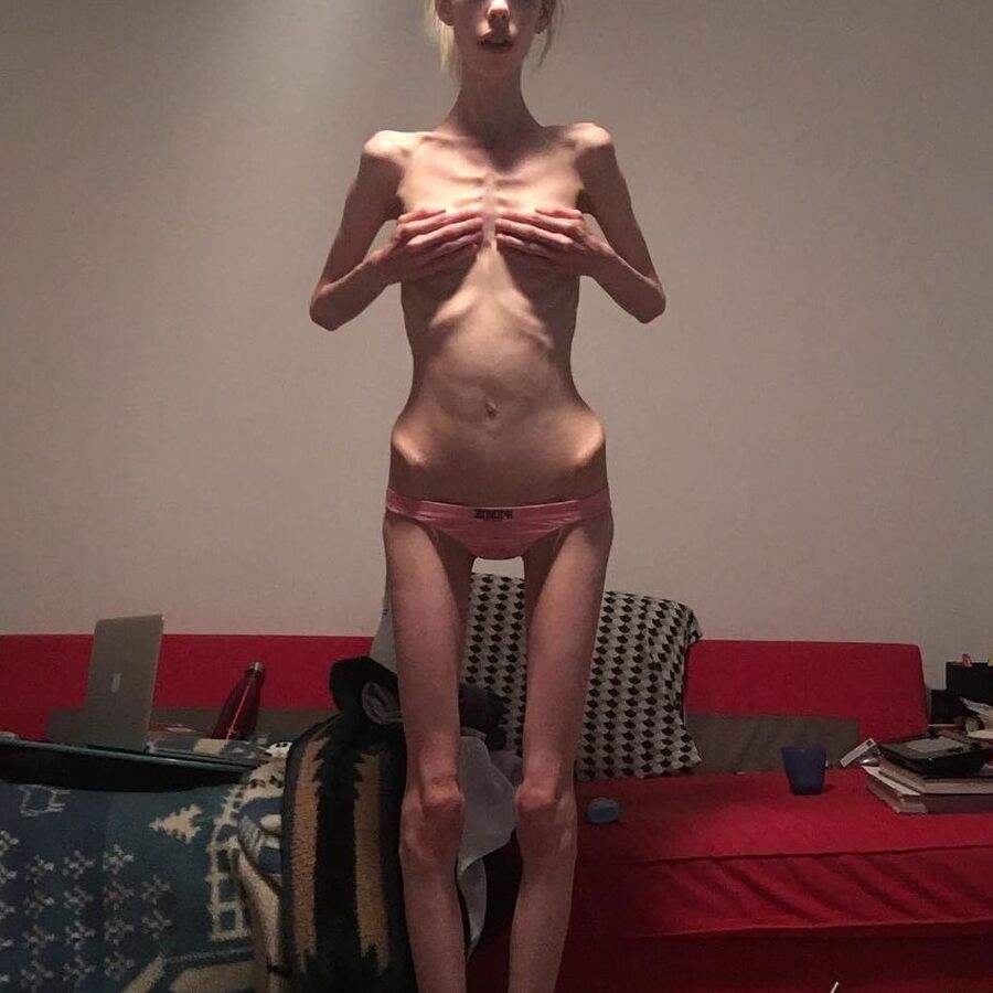 Anorexic-Cunts