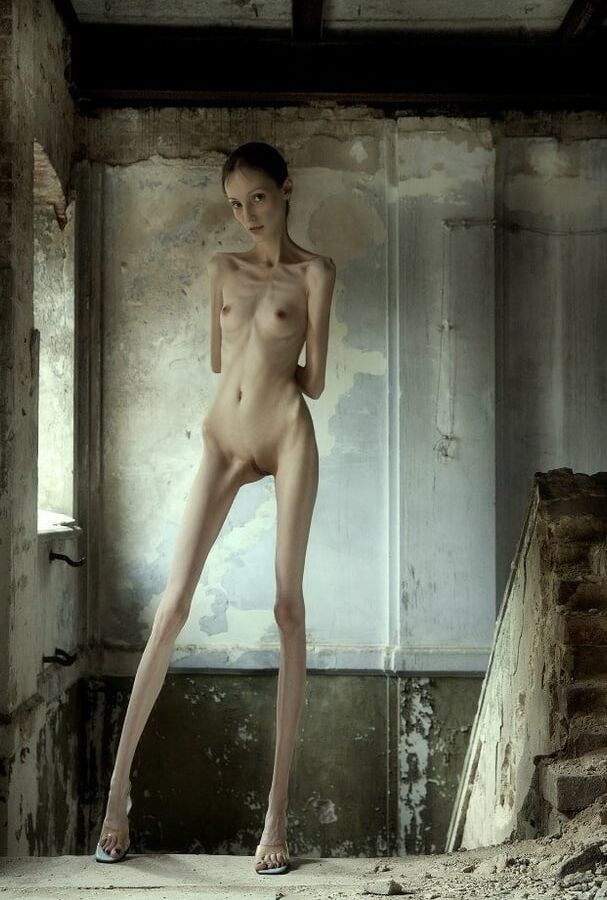 Anorexic-Cunts