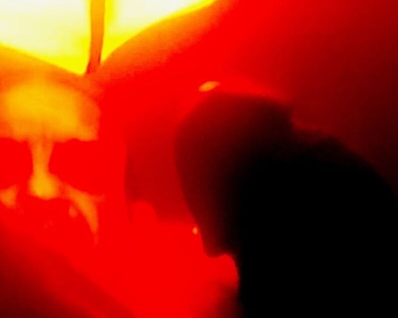 Eros