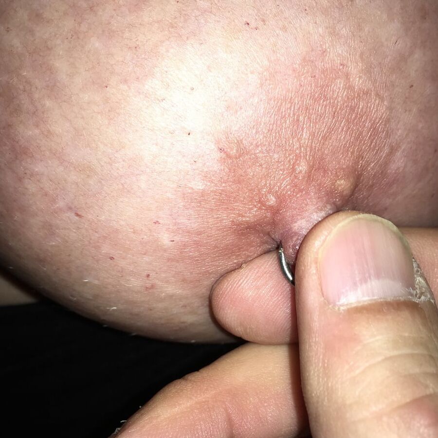 german slut IIIV