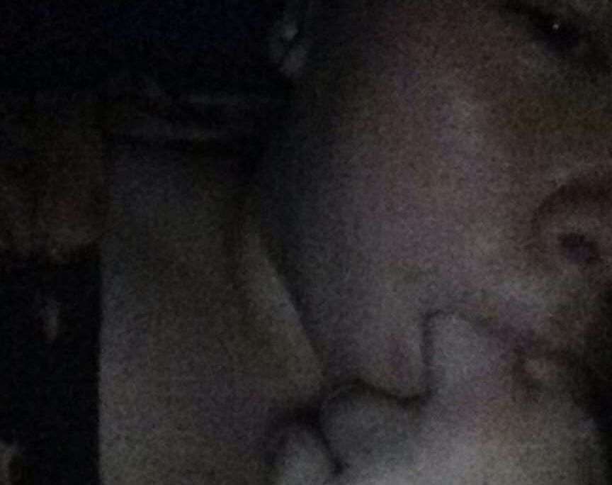 Expose K