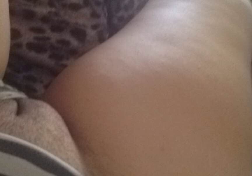 Expose K