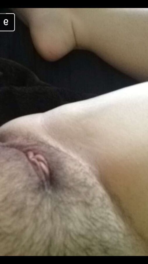Expose K