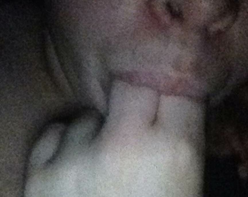 Expose K