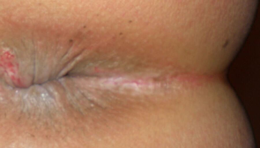 My girlie butthole as year old