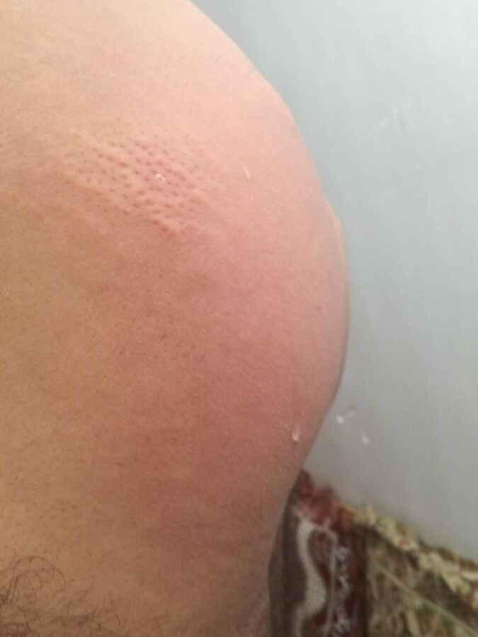 Xxxx