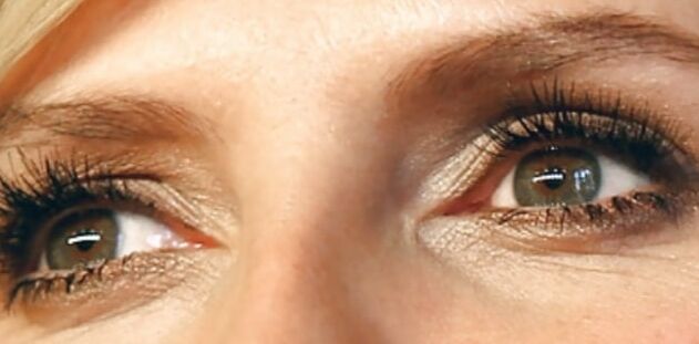 Eyes