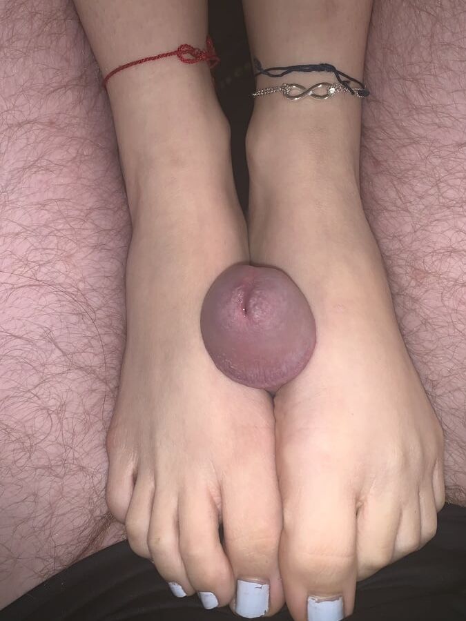 Legs and feet