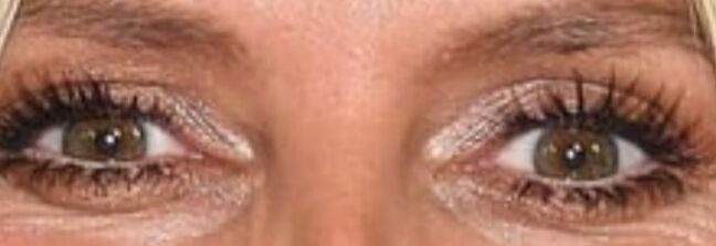Eyes