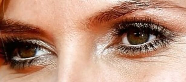Eyes