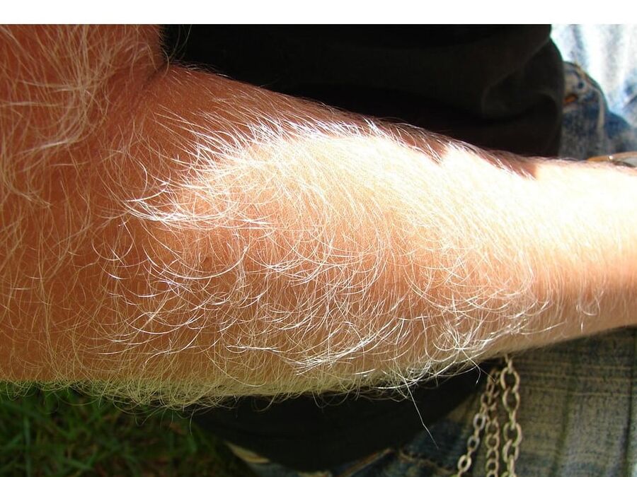 facial hair women hairy back and arms collection
