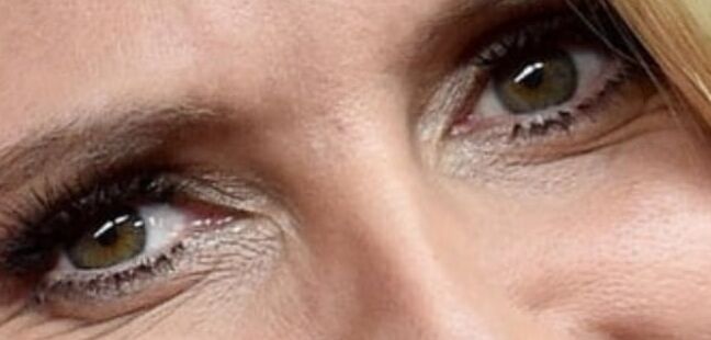 Eyes