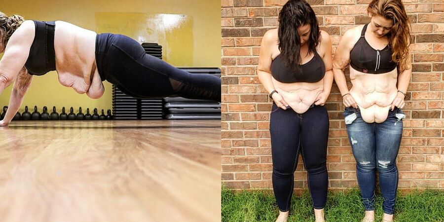 Saggy Weight Loss Skin - The Fetish You Never Knew You Had