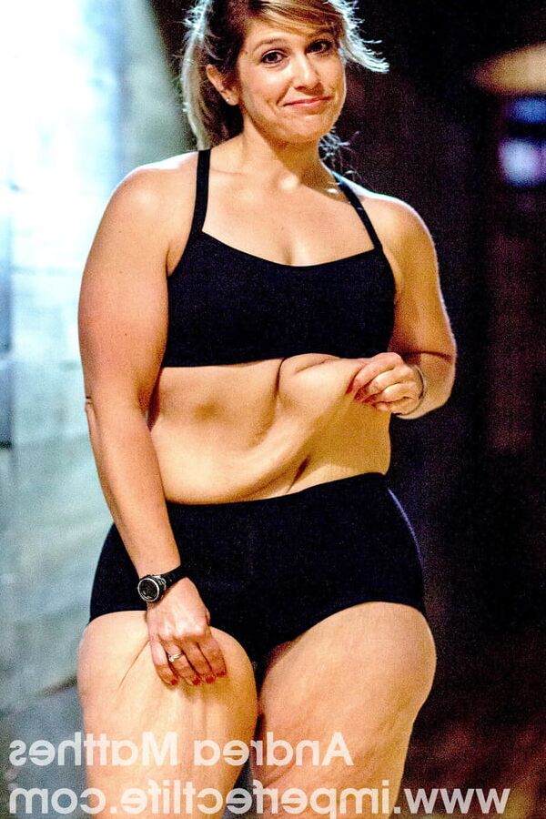 Saggy Weight Loss Skin - The Fetish You Never Knew You Had