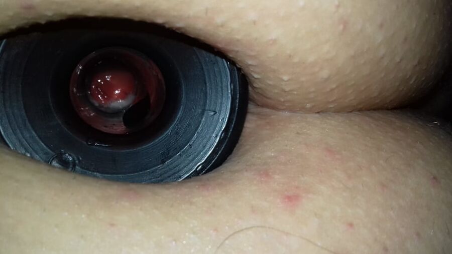 anal play