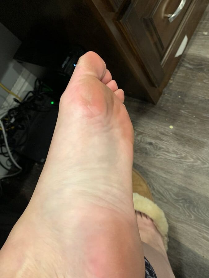 Feet picts from work