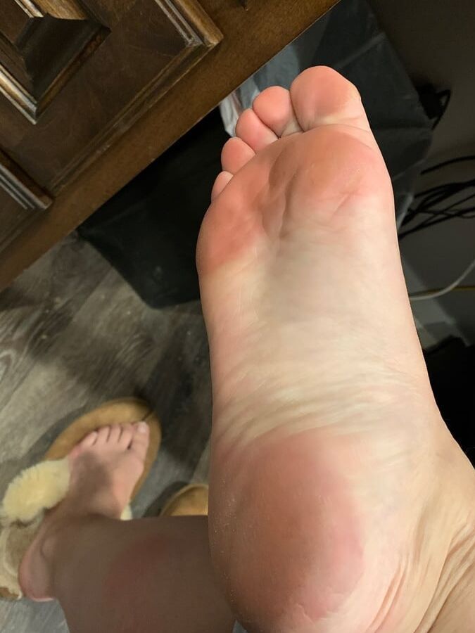 Feet picts from work