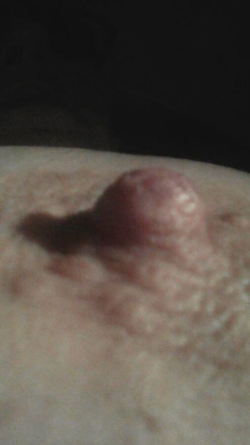 NIPPELS