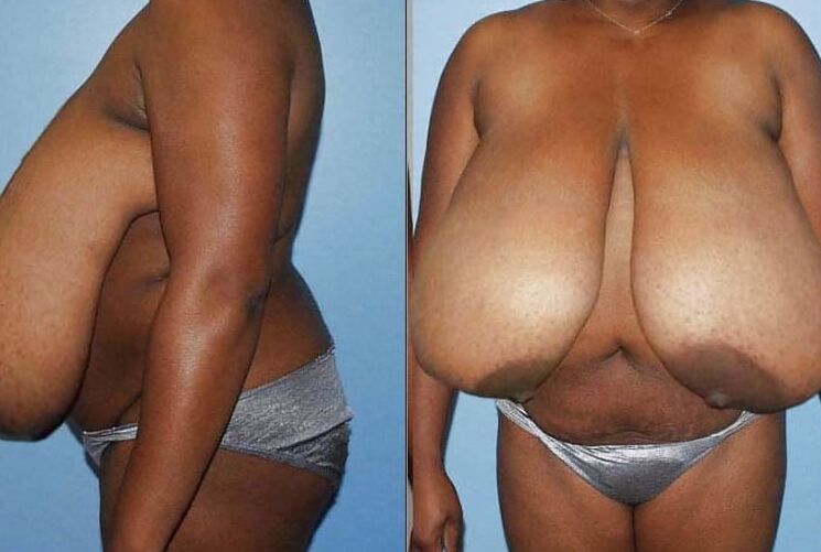 Huge black tits are beautiful