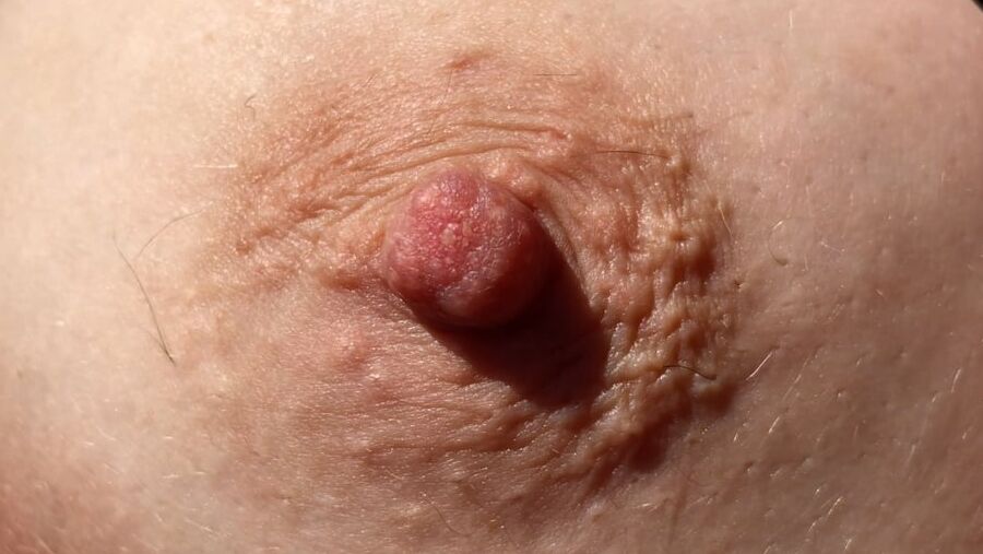 My nipples