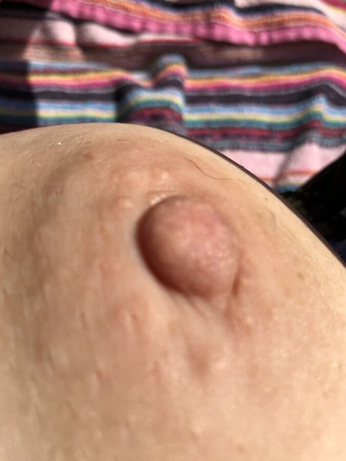 My nipples