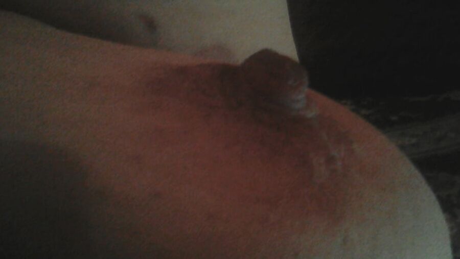 NIPPELS