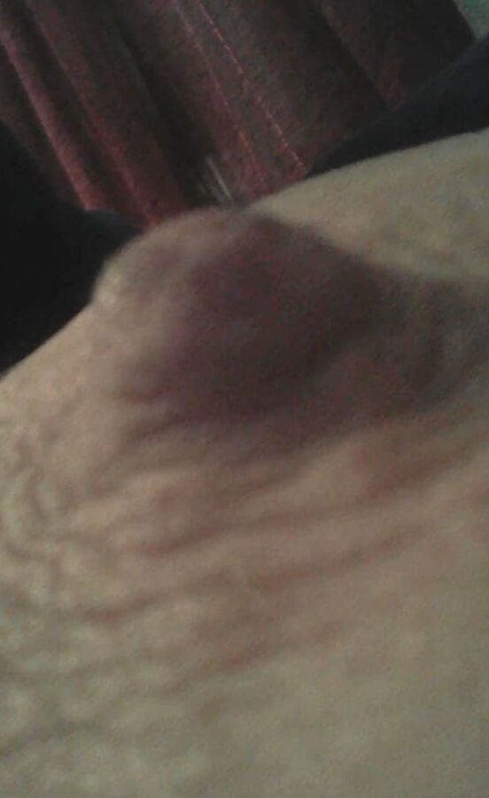 NIPPELS