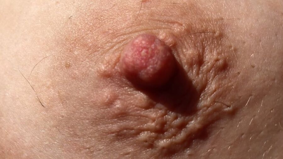 My nipples