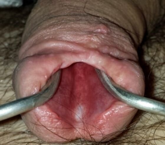 Urethra Fun