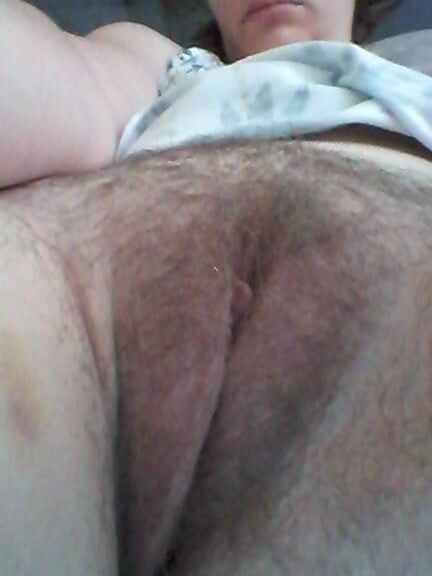Poils,pilosity
