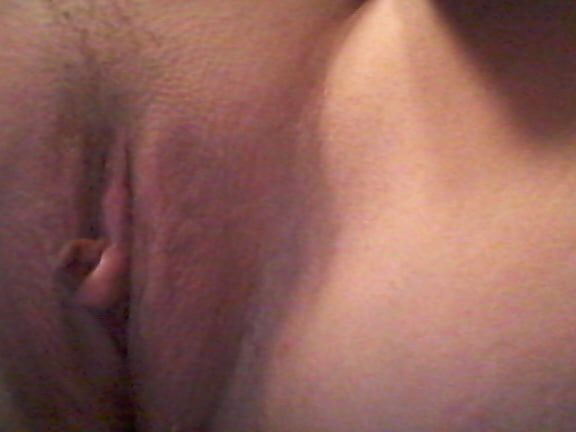 Poils,pilosity