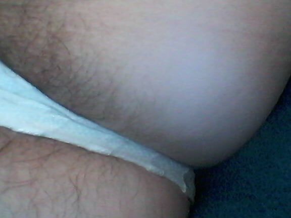 Poils,pilosity