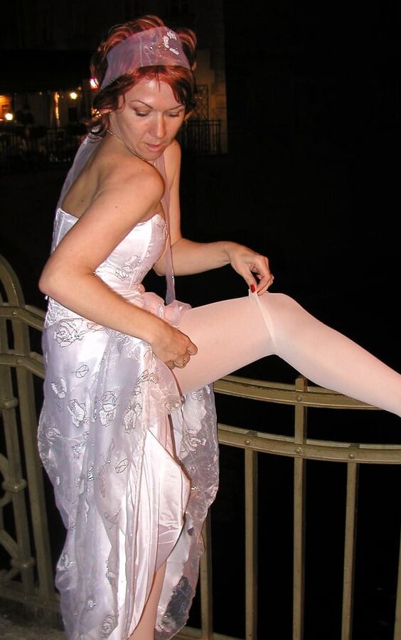 white legs