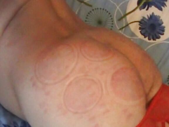 Scottish Ex From Videos