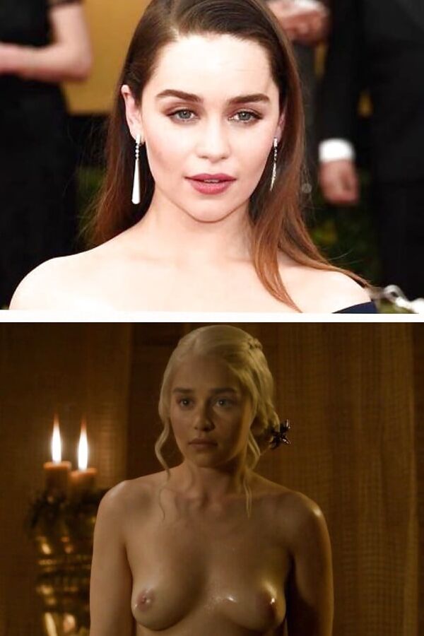 Before and Aftet - Celebrities