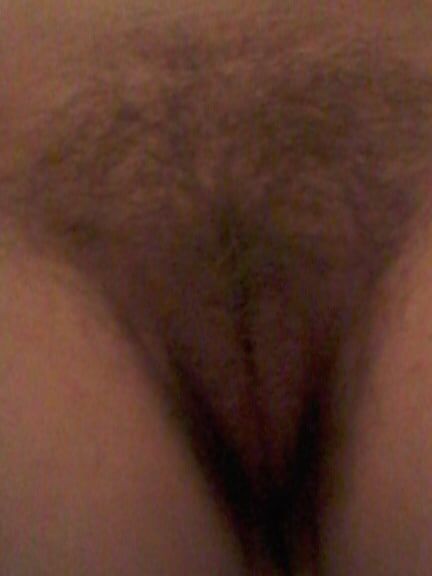 Poils,pilosity