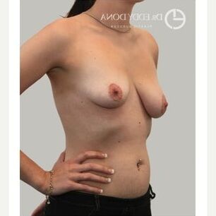 Saggy tits vol