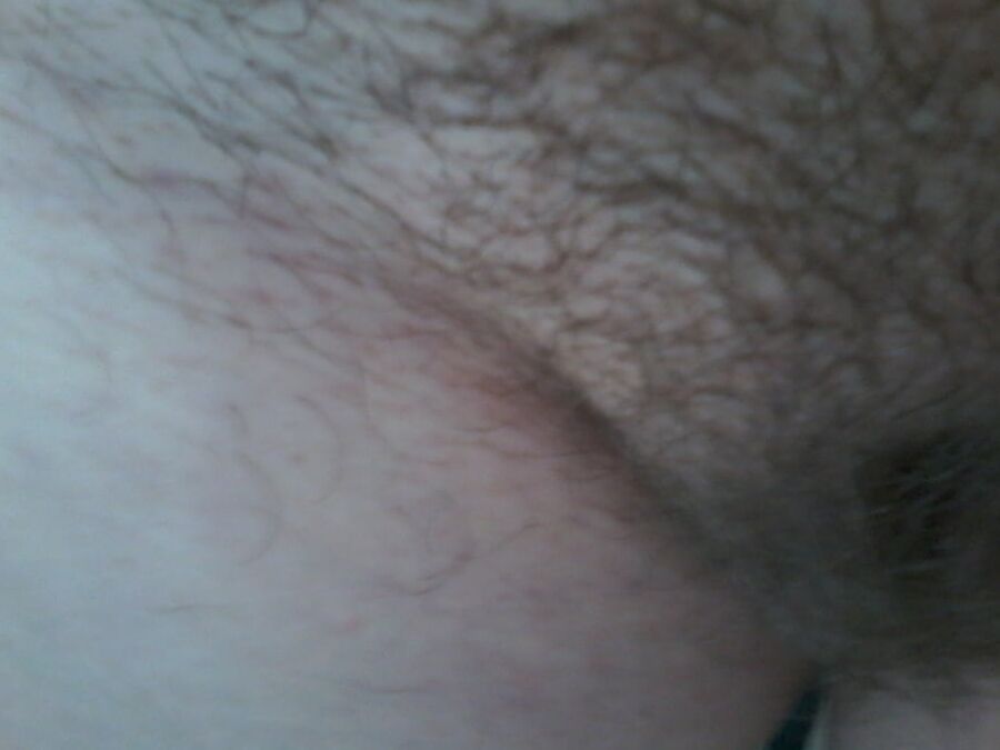 Poils,pilosity