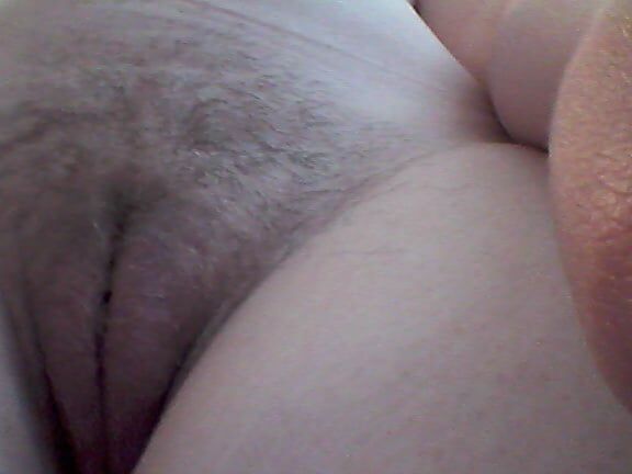 Poils,pilosity