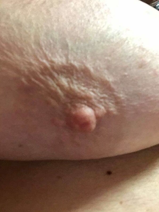Friends Tits