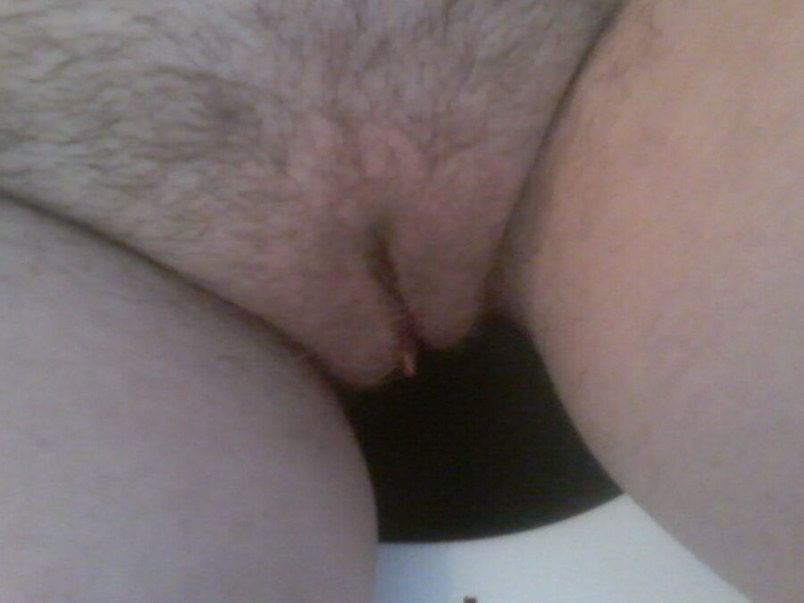 Poils,pilosity