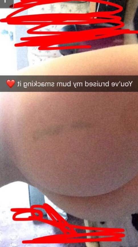 Exposed GF