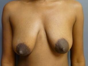 Saggy tits vol
