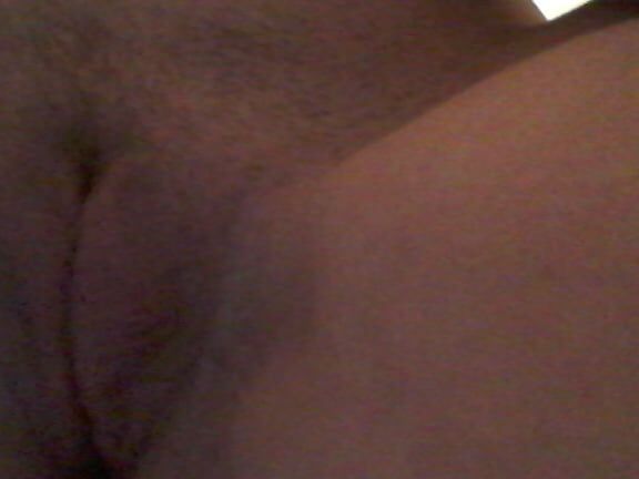 Poils,pilosity