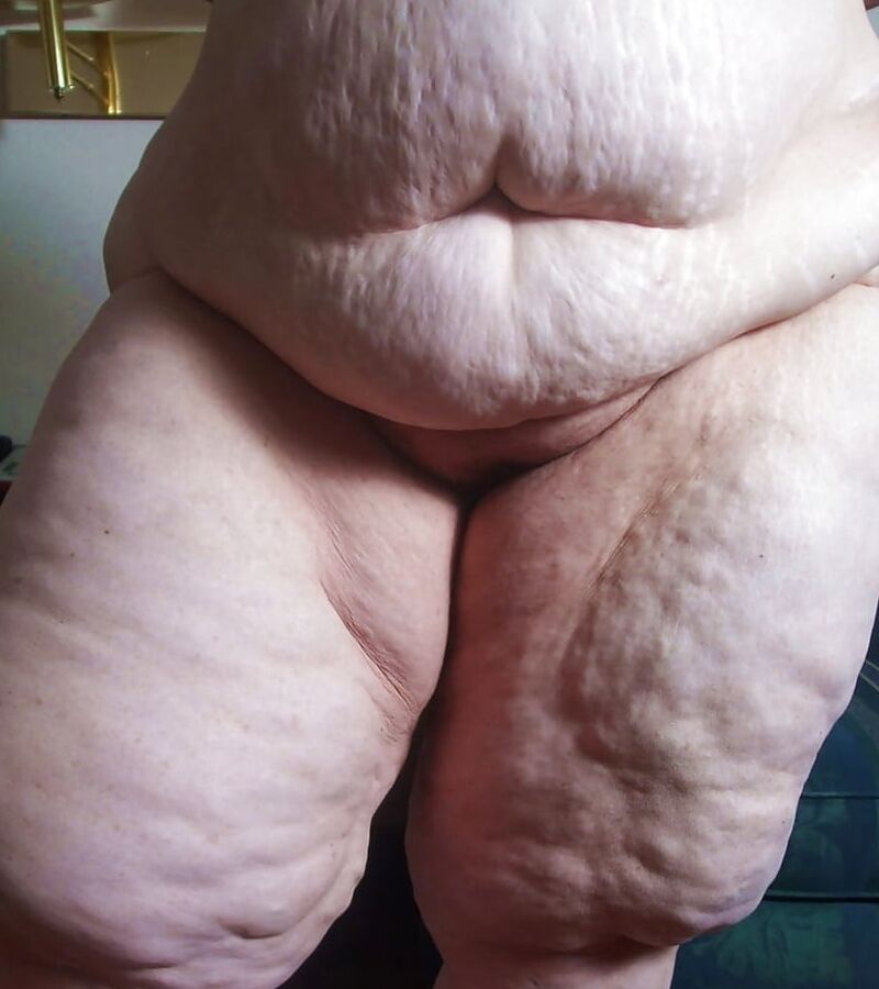 Sexy Cellulite and Stretchmarks
