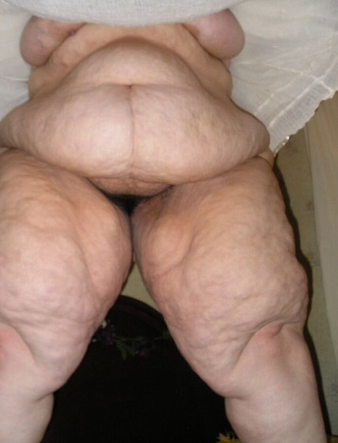 Sexy Cellulite and Stretchmarks